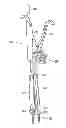 Fig. 01 - Instruments and methods for adjusting separation distance of vertebral bodies with a minimally invasive spinal stabilization procedure