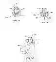 Fig. 05 - Instruments and methods for adjusting separation distance of vertebral bodies with a minimally invasive spinal stabilization procedure