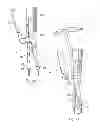 Fig. 13 - Instruments and methods for adjusting separation distance of vertebral bodies with a minimally invasive spinal stabilization procedure