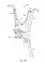 Fig. 14 - Instruments and methods for adjusting separation distance of vertebral bodies with a minimally invasive spinal stabilization procedure