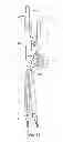 Fig. 20 - Instruments and methods for adjusting separation distance of vertebral bodies with a minimally invasive spinal stabilization procedure