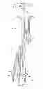 Fig. 23 - Instruments and methods for adjusting separation distance of vertebral bodies with a minimally invasive spinal stabilization procedure