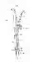 Fig. 24 - Instruments and methods for adjusting separation distance of vertebral bodies with a minimally invasive spinal stabilization procedure