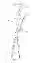 Fig. 26 - Instruments and methods for adjusting separation distance of vertebral bodies with a minimally invasive spinal stabilization procedure