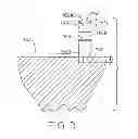 Fig. 04 - Tracked cartilage repair system