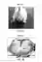 Fig. 04 - Charge-enhanced neural electric stimulation system