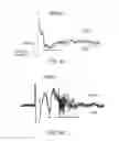 Fig. 09 - Charge-enhanced neural electric stimulation system
