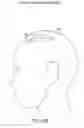 Fig. 40 - Charge-enhanced neural electric stimulation system