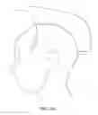 Fig. 41 - Charge-enhanced neural electric stimulation system