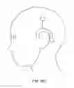 Fig. 44 - Charge-enhanced neural electric stimulation system
