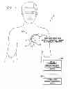 Fig. 02 - Systems and methods for early detection of lead breaches using cross-lead impedances detected by an implantable medical device