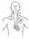 Fig. 01 - Implantable neurostimulator-implemented method for managing tachyarrhythmia through vagus nerve stimulation