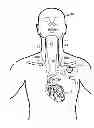 Fig. 01 - Implantable neurostimulator-implemented method for enhancing heart failure patient awakening through vagus nerve stimulation