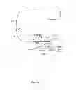 Fig. 10 - Cardiac stimulation using intravascularly-deliverable electrode assemblies