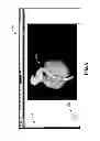 Fig. 06 - System and methods to facilitate providing therapy to a patient