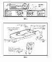 Fig. 04 - NON-INVASIVE INTRAORAL ELECTRICAL STIMULATOR SYSTEM AND METHOD FOR TREATMENT OF OBSTRUCTIVE SLEEP APNEA (OSA)