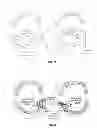 Fig. 08 - NON-INVASIVE INTRAORAL ELECTRICAL STIMULATOR SYSTEM AND METHOD FOR TREATMENT OF OBSTRUCTIVE SLEEP APNEA (OSA)