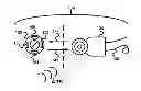 Fig. 01 - External Unit of an Implanted Medical Device