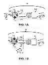 Fig. 02 - External Unit of an Implanted Medical Device