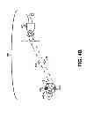Fig. 07 - External Unit of an Implanted Medical Device
