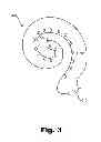 Fig. 04 - Systems and methods of facilitating manual adjustment of one or more cochlear implant system control parameters