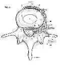 Fig. 02 - System and method for electrical stimulation of the lumbar vertebral column
