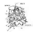 Fig. 04 - System and method for electrical stimulation of the lumbar vertebral column