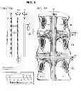 Fig. 06 - System and method for electrical stimulation of the lumbar vertebral column