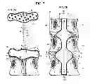 Fig. 08 - System and method for electrical stimulation of the lumbar vertebral column