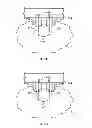 Fig. 06 - Methods and devices for treating tissue