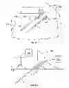 Fig. 16 - Methods and devices for treating tissue