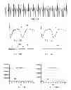 Fig. 10 - Method and apparatus for measuring and treating shivering during therapeutic temperature control