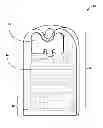 Fig. 01 - Implantable medical device header