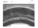 Fig. 06 - Stents having a hybrid pattern and methods of manufacture