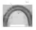 Fig. 08 - Stents having a hybrid pattern and methods of manufacture