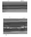 Fig. 09 - Stents having a hybrid pattern and methods of manufacture