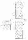 Fig. 04 - Dual Capture Device For Stent Graft Delivery System And Method For Capturing A Stent Graft