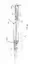 Fig. 22 - Dual Capture Device For Stent Graft Delivery System And Method For Capturing A Stent Graft