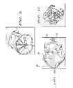 Fig. 28 - Dual Capture Device For Stent Graft Delivery System And Method For Capturing A Stent Graft