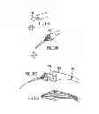 Fig. 63 - Dual Capture Device For Stent Graft Delivery System And Method For Capturing A Stent Graft