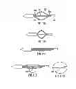 Fig. 64 - Dual Capture Device For Stent Graft Delivery System And Method For Capturing A Stent Graft