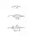 Fig. 65 - Dual Capture Device For Stent Graft Delivery System And Method For Capturing A Stent Graft