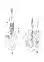 Fig. 06 - Methods of implanting a prosthesis and treating an aneurysm