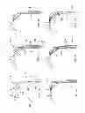 Fig. 08 - Methods of implanting a prosthesis and treating an aneurysm
