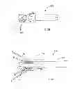 Fig. 10 - Methods of implanting a prosthesis and treating an aneurysm
