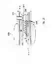Fig. 12 - Methods of implanting a prosthesis and treating an aneurysm