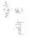 Fig. 15 - Methods of implanting a prosthesis and treating an aneurysm