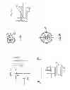 Fig. 20 - Methods of implanting a prosthesis and treating an aneurysm