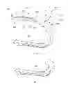 Fig. 24 - Methods of implanting a prosthesis and treating an aneurysm