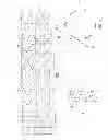 Fig. 02 - Methods of implanting a prosthesis